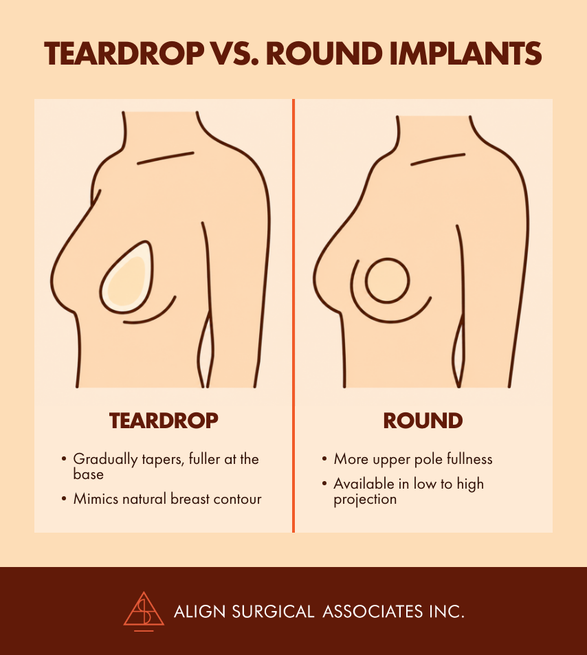 Illustration comparing teardrop and round breast implants in side-profile breast diagrams. The teardrop implant is shown with a tapered shape that is fuller at the base and designed to mimic a natural breast contour. The round implant is shown as a circular shape that provides more upper pole fullness and is available in low to high projection. The graphic is titled "Teardrop vs. Round Implants" and includes the Align Surgical Associates Inc. logo.